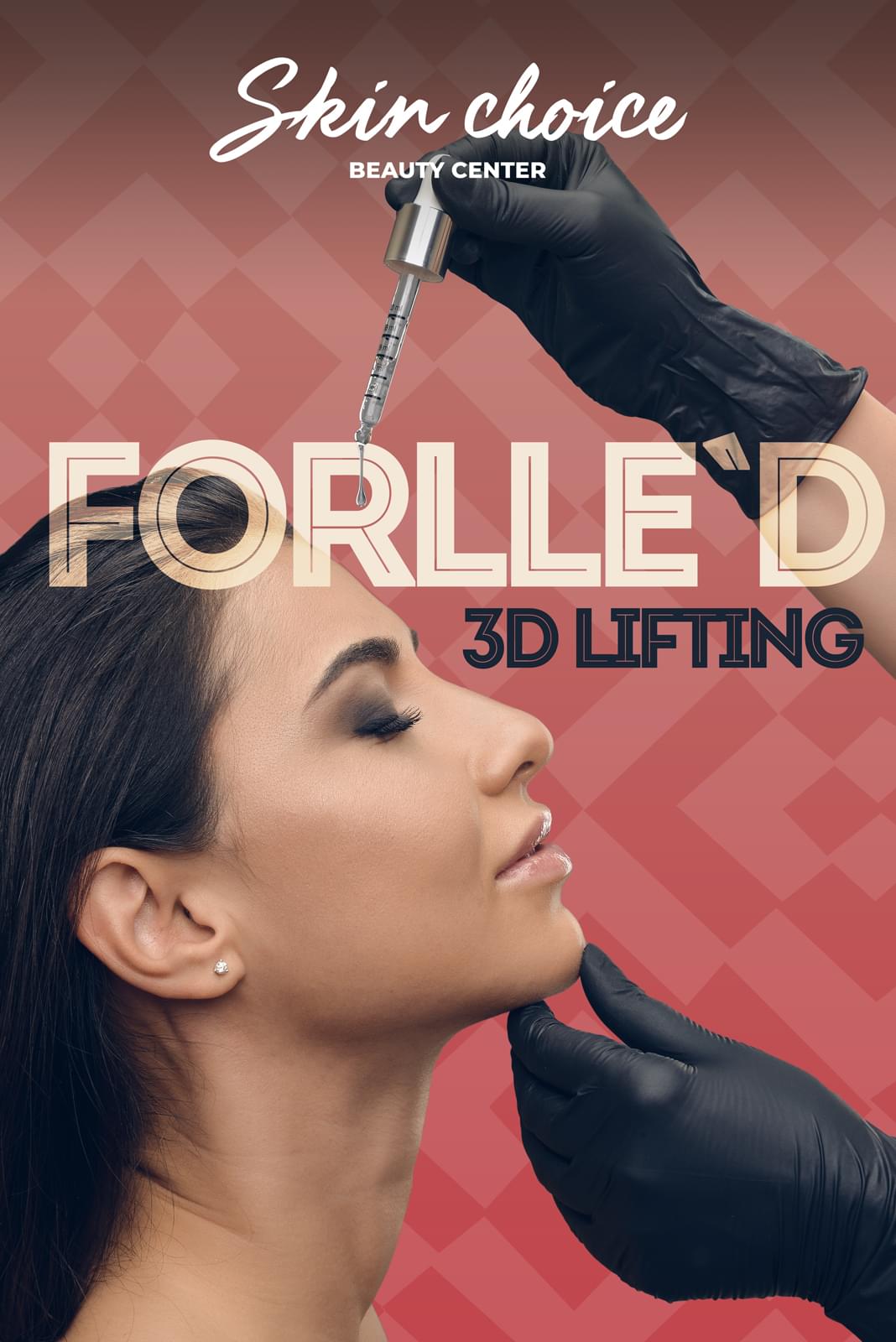 Forlle`d 3D Lifting